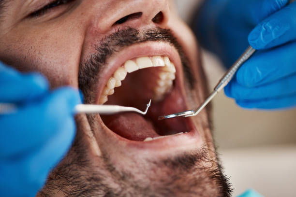 Best Emergency Treatment for Oral Infections in Jefferson, GA